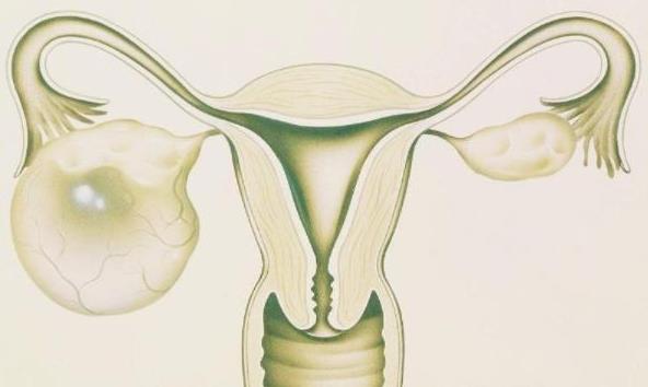 多囊卵巢综合征要怎么调理